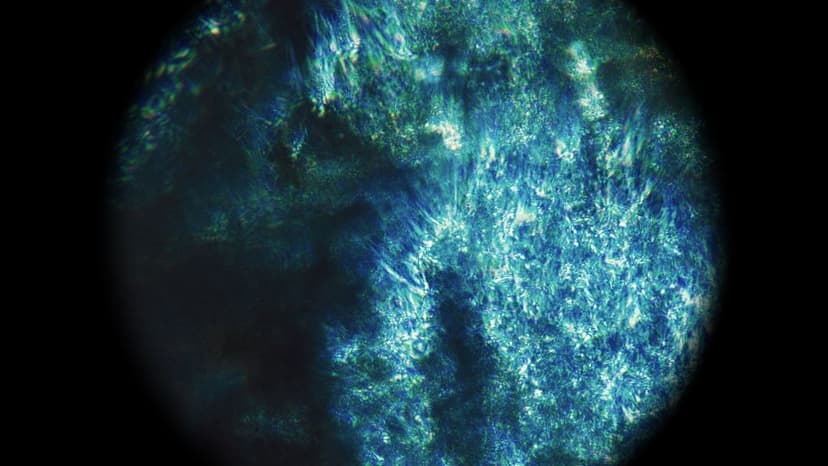Endometriosis and the Brain